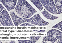 The islets of Langerhans play a crucial role in blood sugar regulation. Fayette A Reynolds/Berkshire Community College Bioscience Image Library via Flickr